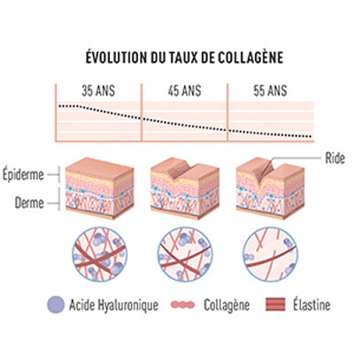 Evolution du taux de collag&egrave;ne